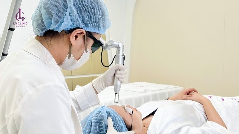Trị thâm mụn tại LG Clinic