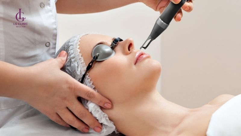 Laser Picosecond trị thâm mụn