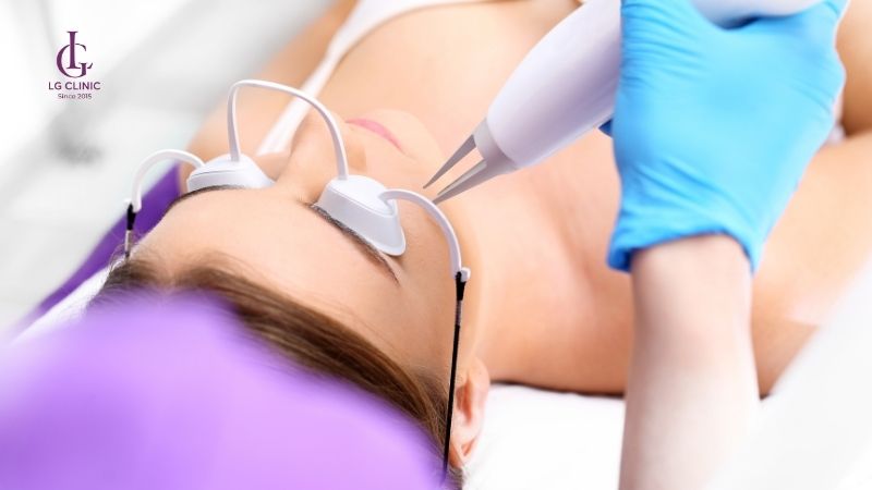 laser trị thâm mụn hiệu quả