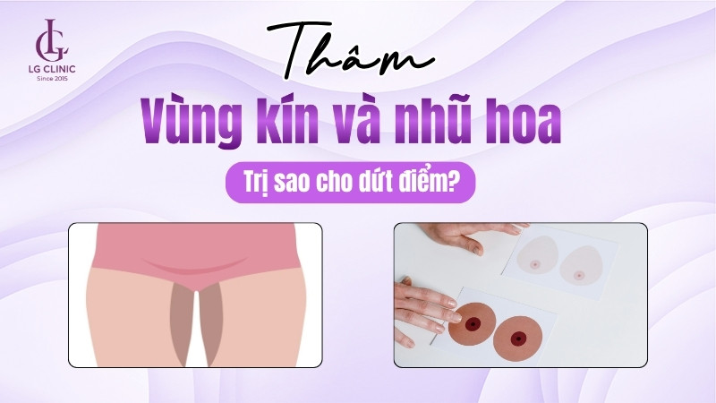 cách trị thâm nhũ hoa và vùng kín