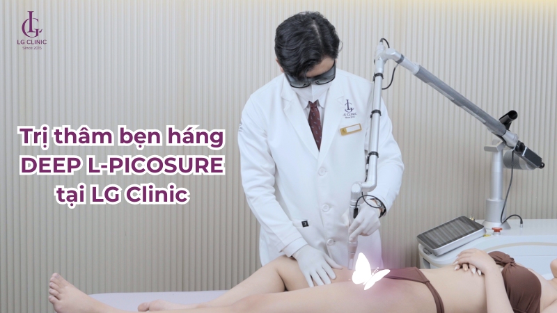 trị thâm bẹn háng bằng deep l-picosure
