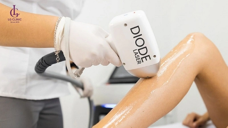 diode laser triệt lông