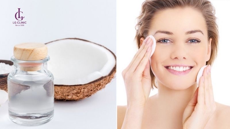 dầu dừa có thể trị thâm mụn