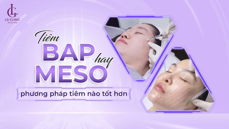 nên tiêm meso hay tiêm bap