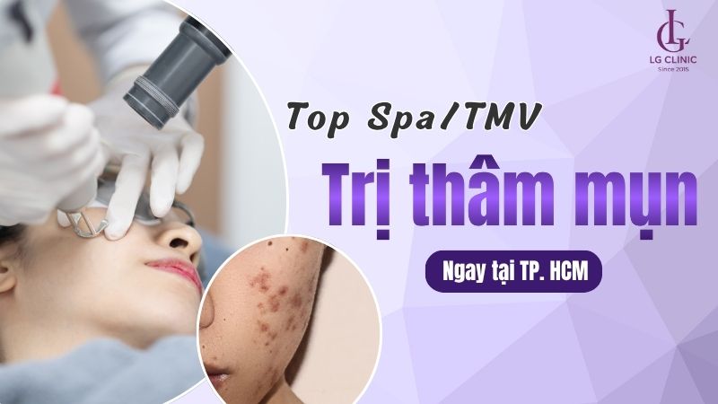 spa trị thâm mụn tại tp hcm