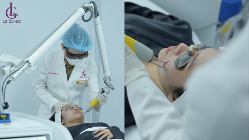 spa trị thâm mụn