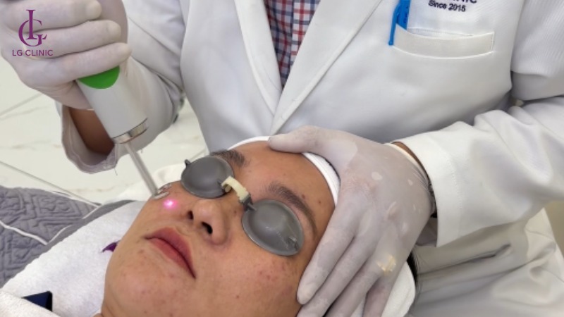 spa trị thâm mụn