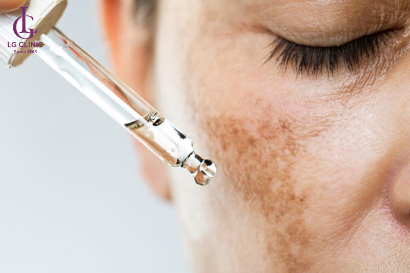 sử dụng retinoid