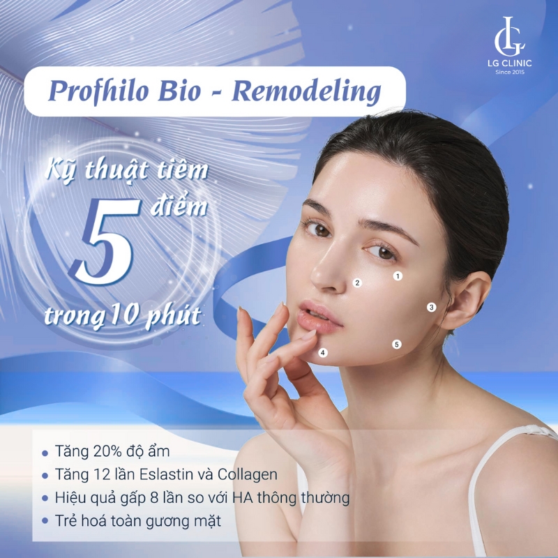 5 điểm tiêm sinh học trên mỗi bên mặt