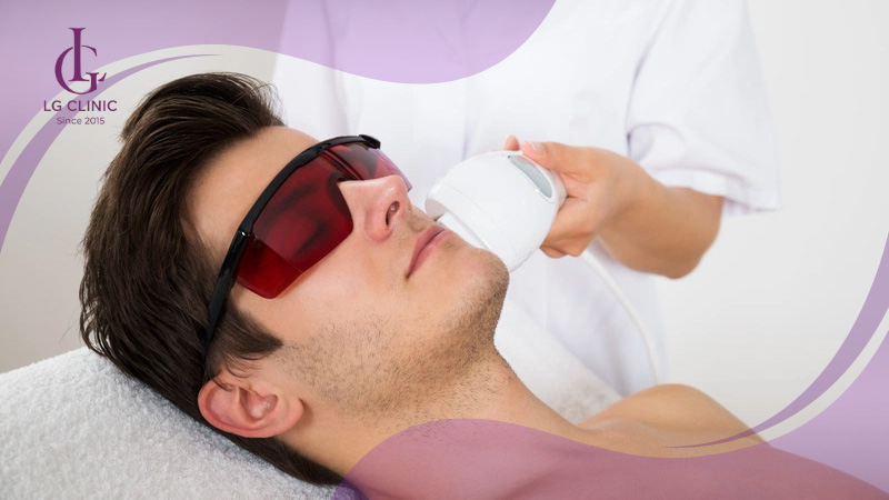 triệt râu vĩnh viễn là gì