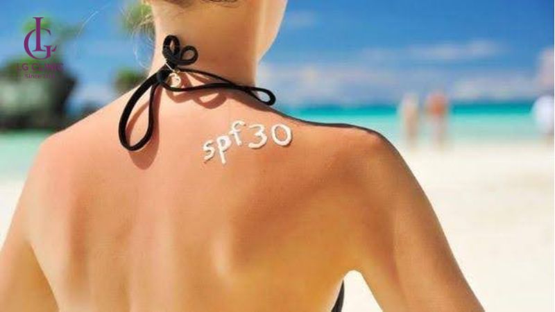 Thoa kem chống nắng SPF 30 để ngăn ngừa ung thư da