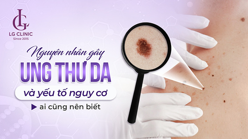 Ung thư da