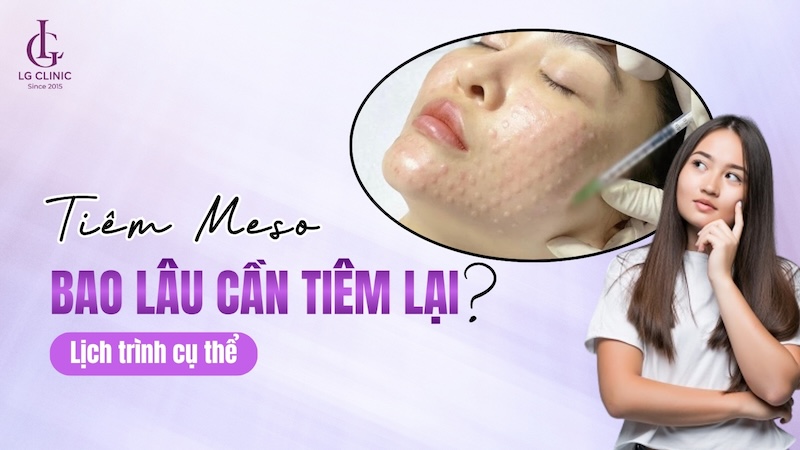 bao lâu tiêm meso 1 lần