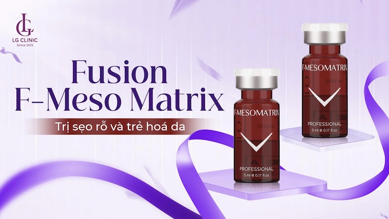 fusion f-meso matrix