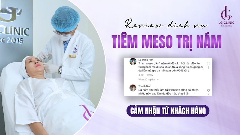 review tiêm meso trị nám