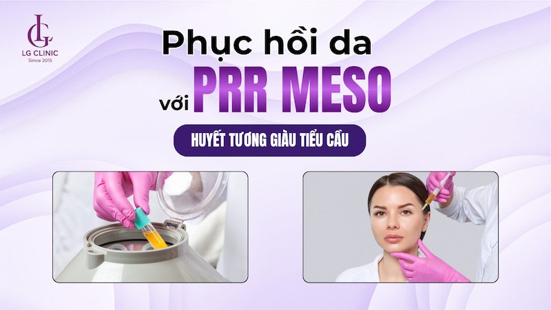 tiêm meso prp