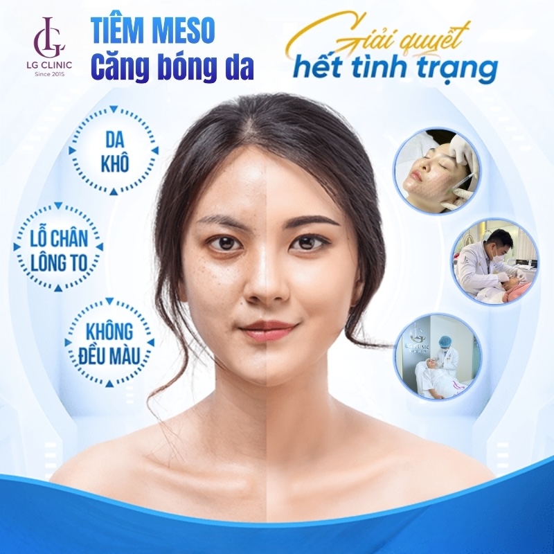 da khô phù hợp để tiêm meso căng bóng