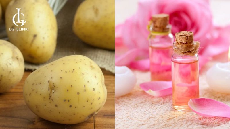 cách trị thâm mông cấp tốc bằng khoai tây và nước hoa hồng