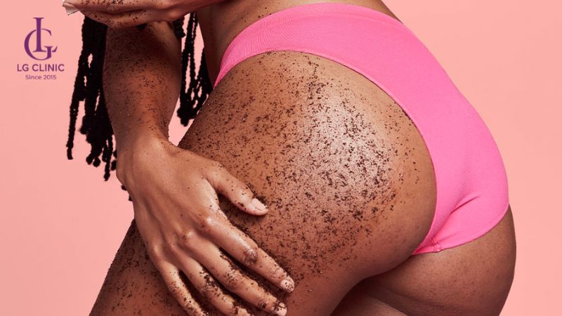 sản phẩm trị thâm mông