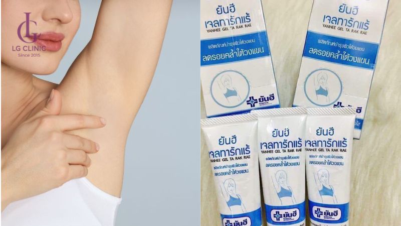 sản phẩm trị thâm nách - kem trị thâm nách