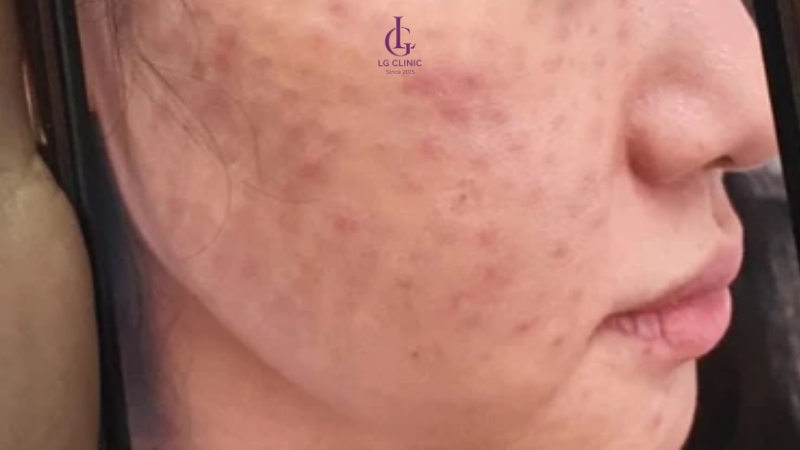kích ứng phải báo bác sĩ ngay