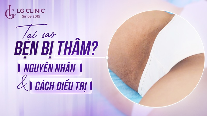 tại sao bẹn bị thâm
