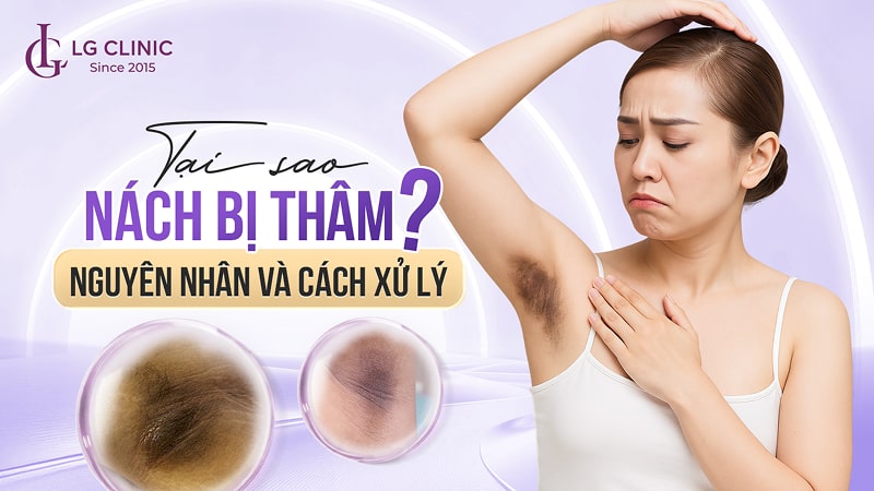 tại sao nách bị thâm