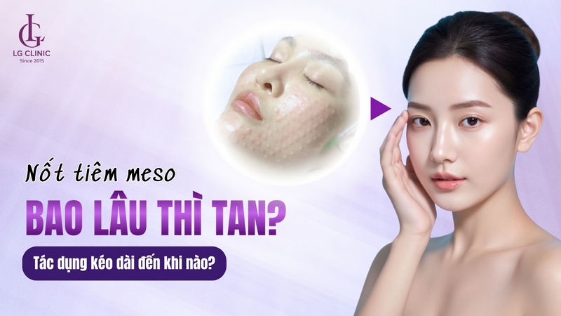 tiêm meso bao lâu thì tan