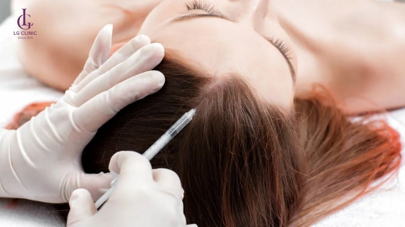 liệu pháp meso đưa trực tiếp dưỡng chất vào tóc