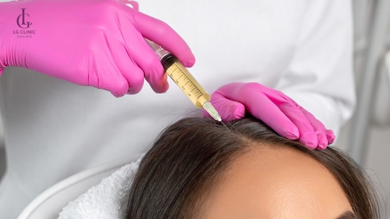 tiêm meso tóc phải được thực hiện bởi bác sĩ