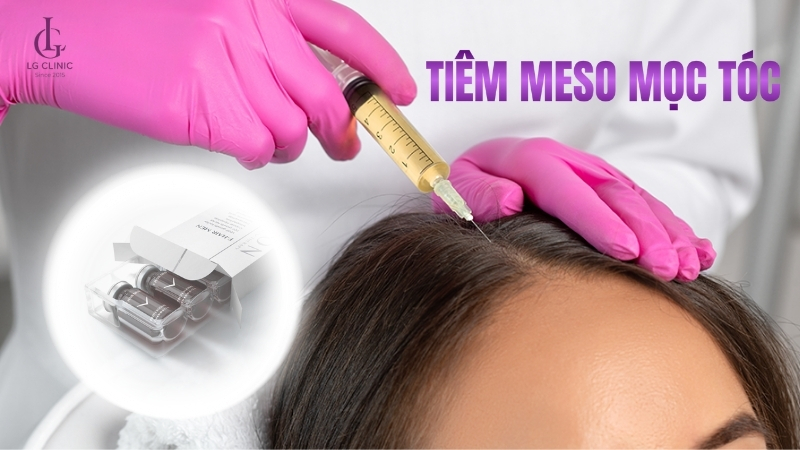 tiêm meso tóc phải thực hiện bởi bác sĩ