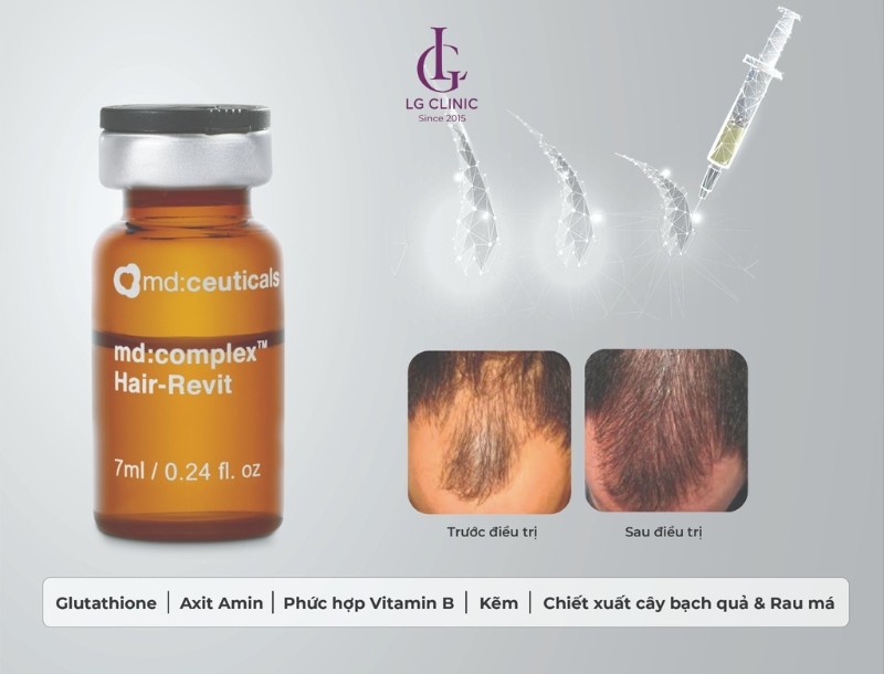 Giá tiêm meso mọc tóc sẽ phụ thuộc nhiều yếu tố