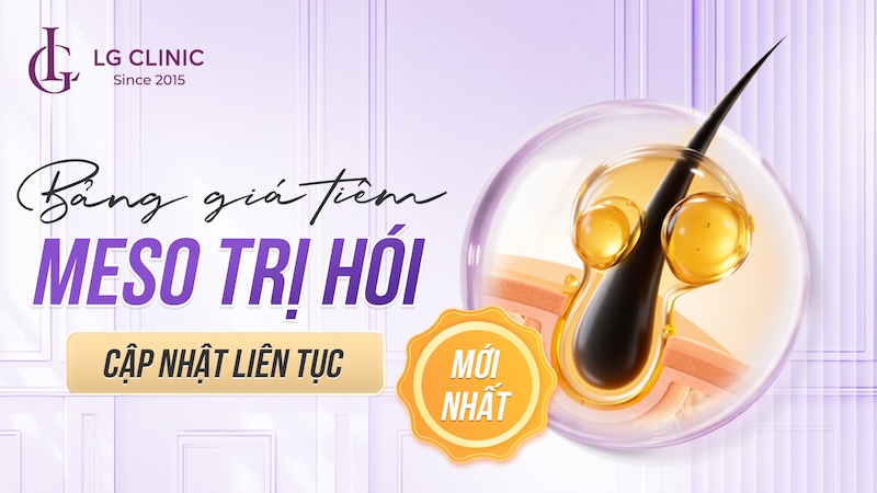 bảng giá tiêm meso hói tóc