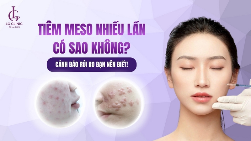 tiêm meso nhiều có tốt không