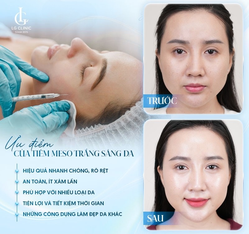 ưu điểm vượt trội