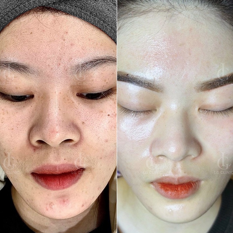 hình ảnh thực tế 2
