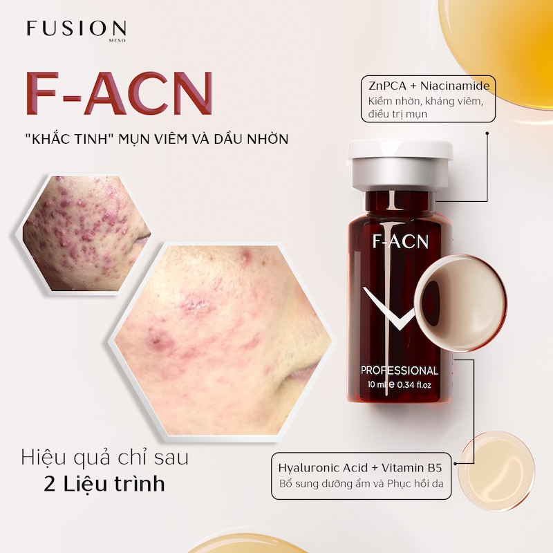 Fusion trị mụn