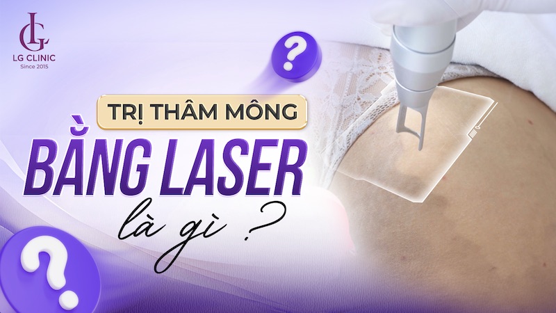 Trị thâm mông bằng Laser