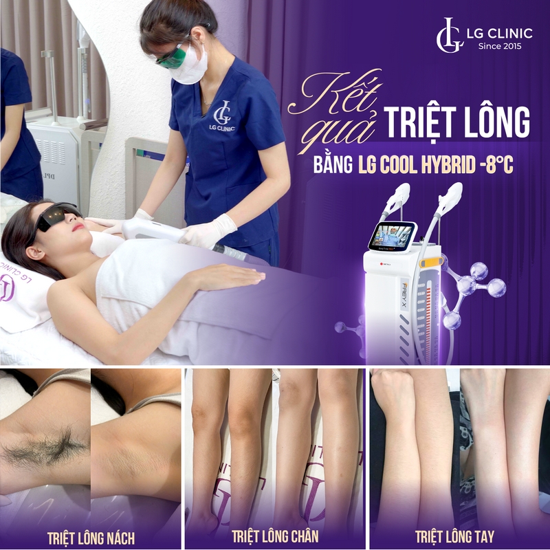 kết quả triệt lông LG Cool Hybrid