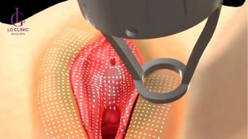 có bầu vùng kín bị thâm, mang thai vùng kín bị thâm đen