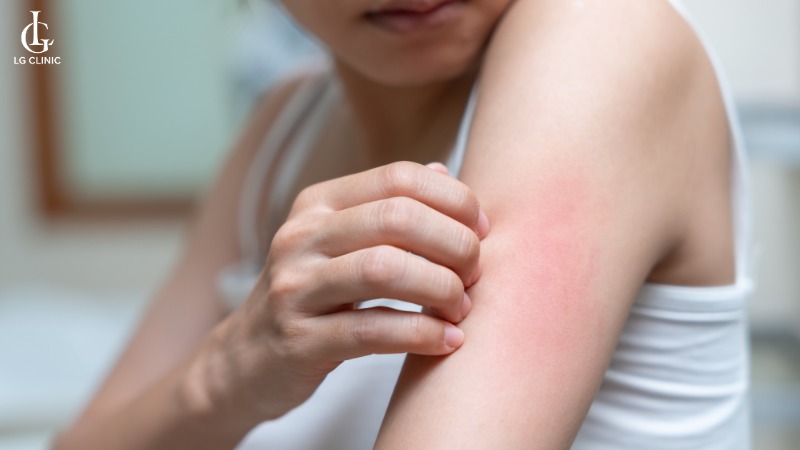 có nên tắm trắng không - tắm trắng có hại không