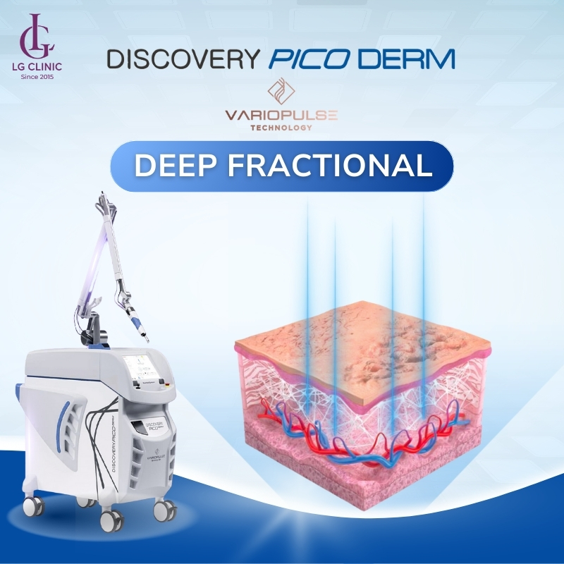công nghệ Deep Fractional