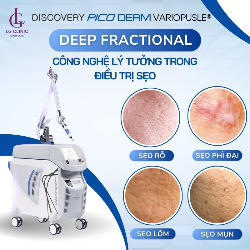công nghệ Deep Fractional
