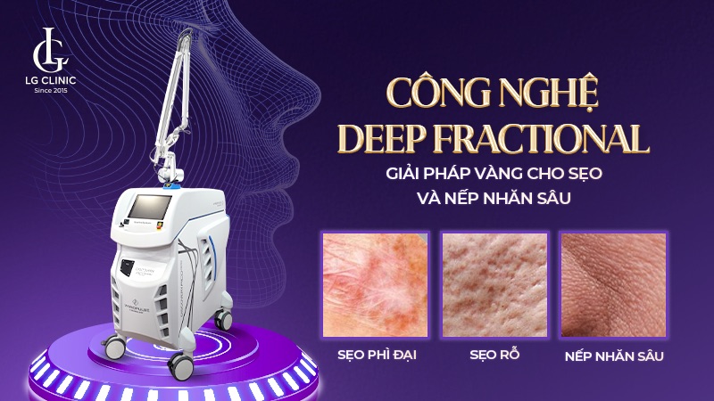 công nghệ Deep Fractional