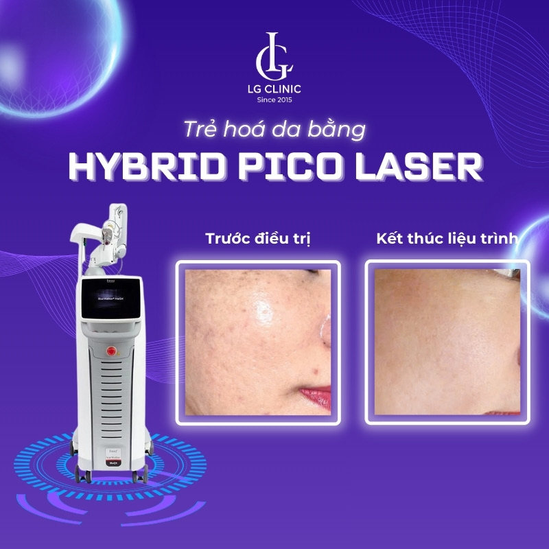 trẻ hoá da bằng hybrid pico laser
