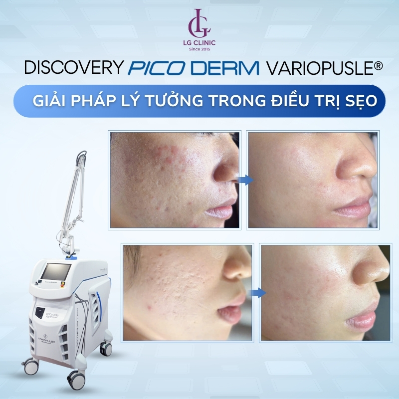Discovery Pico Derm VarioPulse®