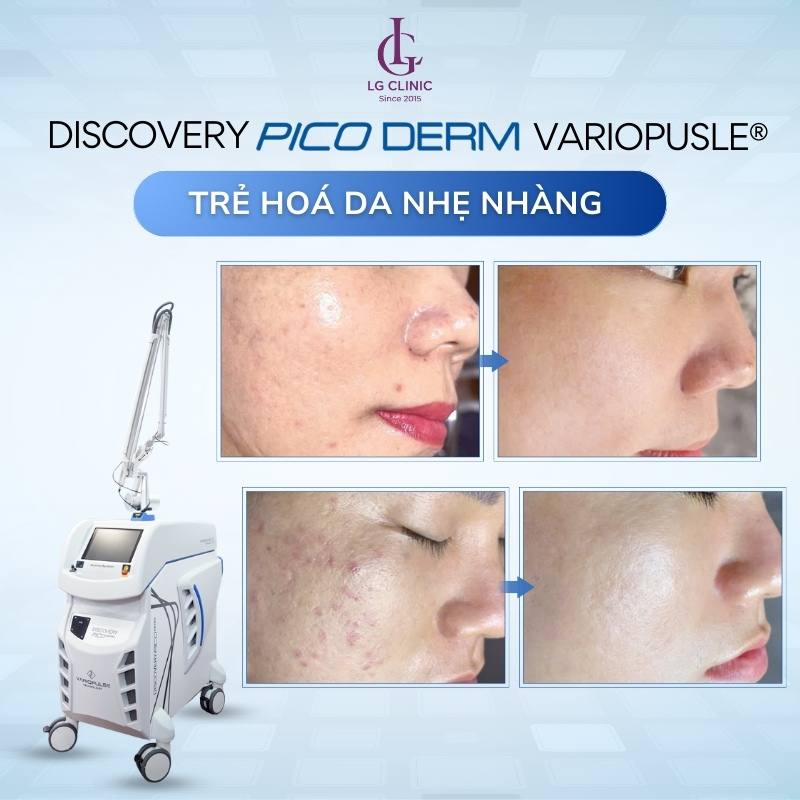 Discovery Pico Derm VarioPulse®