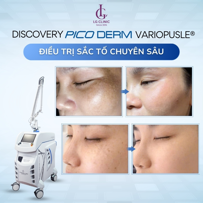 Discovery Pico Derm VarioPulse®