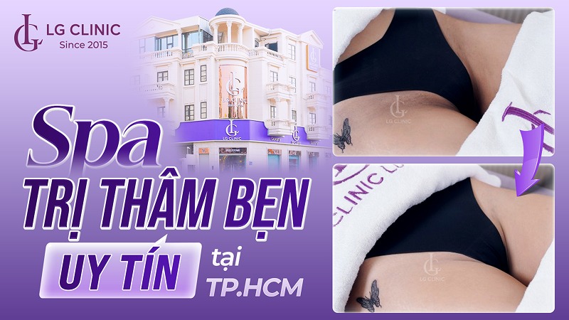 Spa trị thâm bẹn tốt nhất tại TPHCM