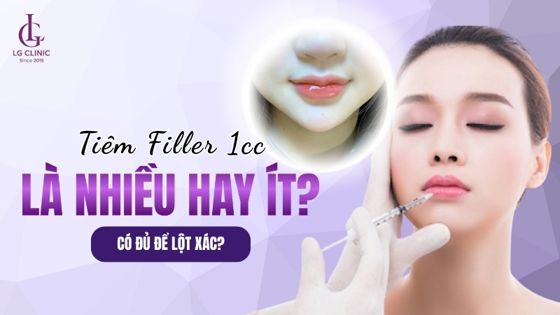 tiêm filler 1cc là gì